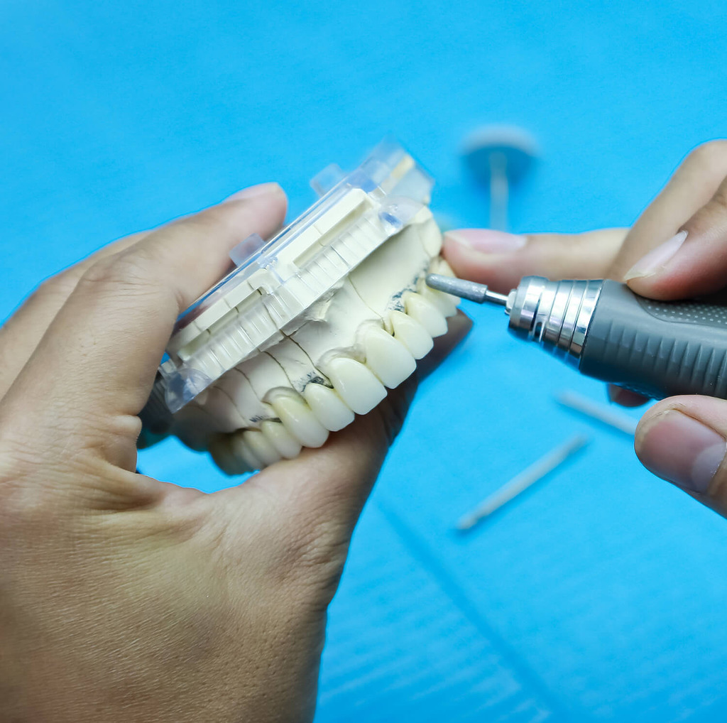 Ảnh làm răng sứ tại Nha khoa Cẩm Tú Nha khoa Quận 1 