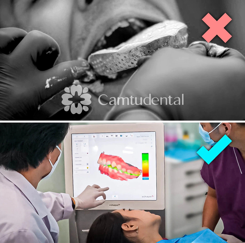 Công nghệ 3D 3Shape® cho phép Cẩm Tú lưu giữ chính xác hình ảnh, vị trí và cấu trúc của răng