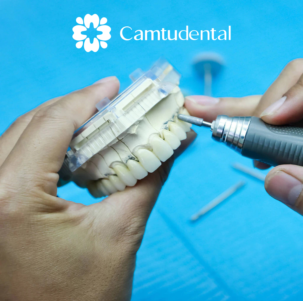 Răng sứ được thiết kế và chế tác bằng công nghệ máy móc hiện đại, đảm bảo khớp với khuôn hàm của bệnh nhân 