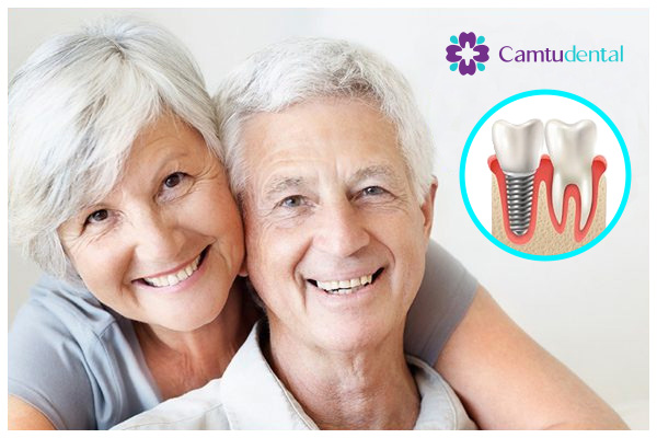 Ưu điểm trồng răng Implant tại Nha khoa Cẩm Tú Quận 1 là tuổi thọ răng cao