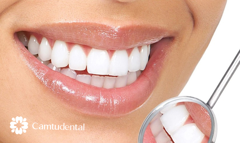image 16 4 - Nên lựa chọn bọc răng sứ hay niềng răng? - Hệ thống Nha khoa Cẩm Tú