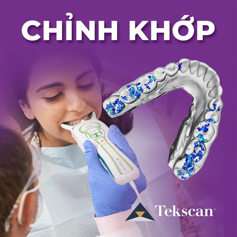 Chỉnh khớp cắn điện toán T-scan trong trình Digital Implant tại Nha khoa Cẩm Tú Quận 1