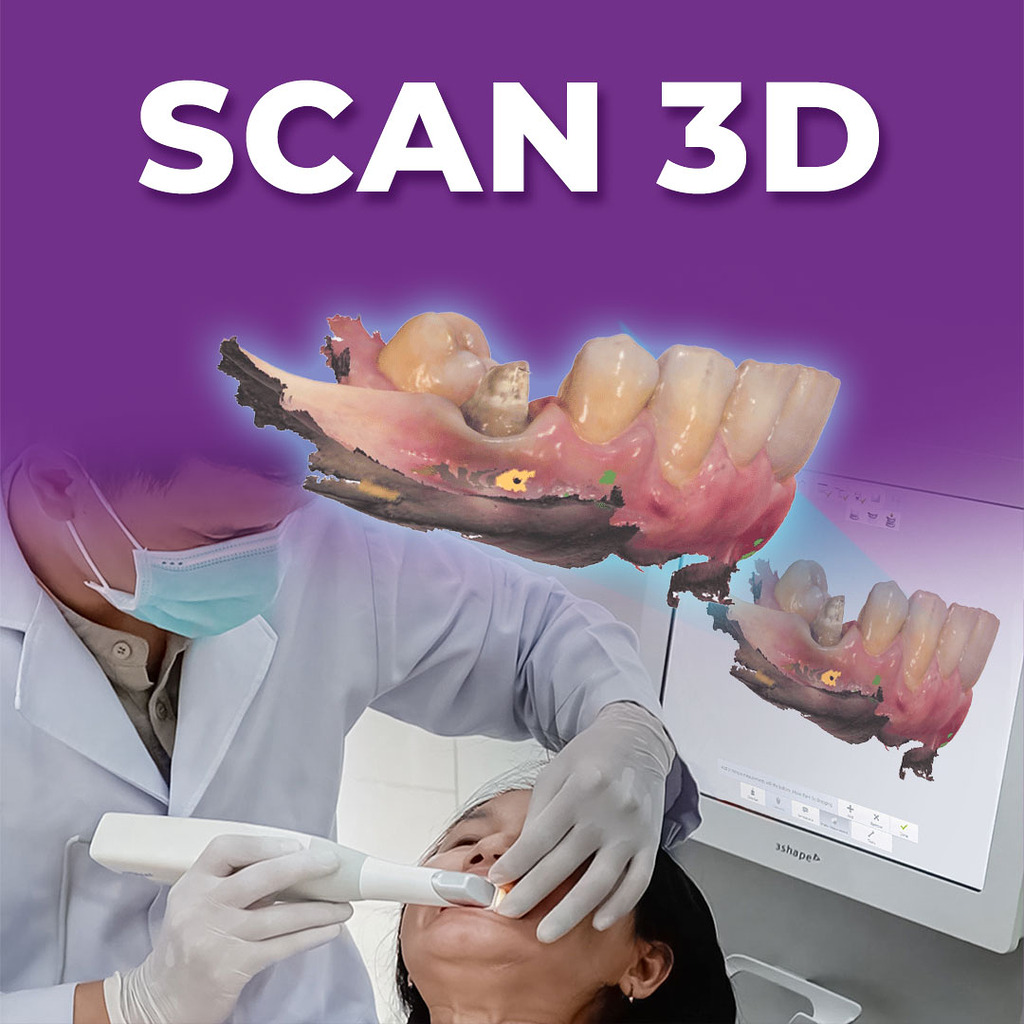 Cận cảnh công nghệ 3Shape 3D Scan tại Nha khoa Cẩm Tú Quận 1