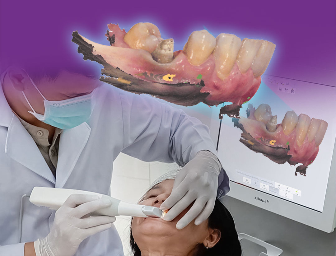 Hình ảnh bác sĩ đang sử dụng máy scan răng bệnh nhân