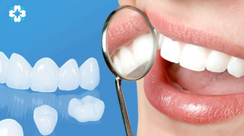 răng sứ và kính soi răng