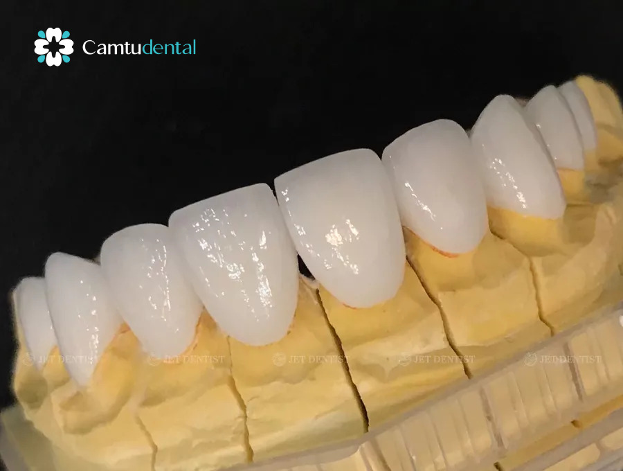 răng sứ cao cấp Caramill
