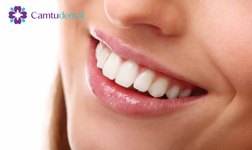 Cận cảnh nụ cười rạng rỡ với hàm răng trắng đều đều, nổi bật là kết quả của dịch vụ nha khoa thẩm mỹ tại Nha khoa Camtu.