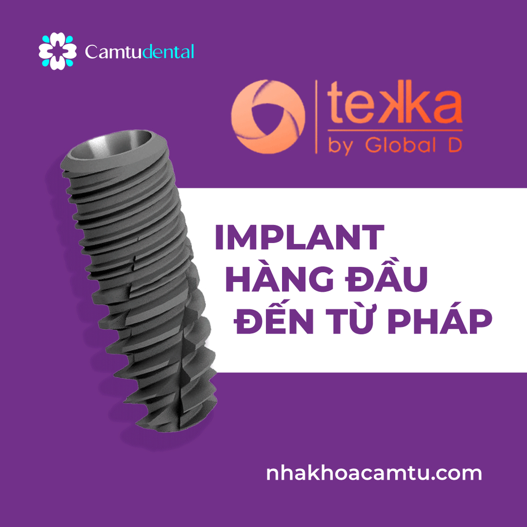 Trụ Implant Tekka được mô phỏng bởi Nha khoa Cẩm Tú Quận 1