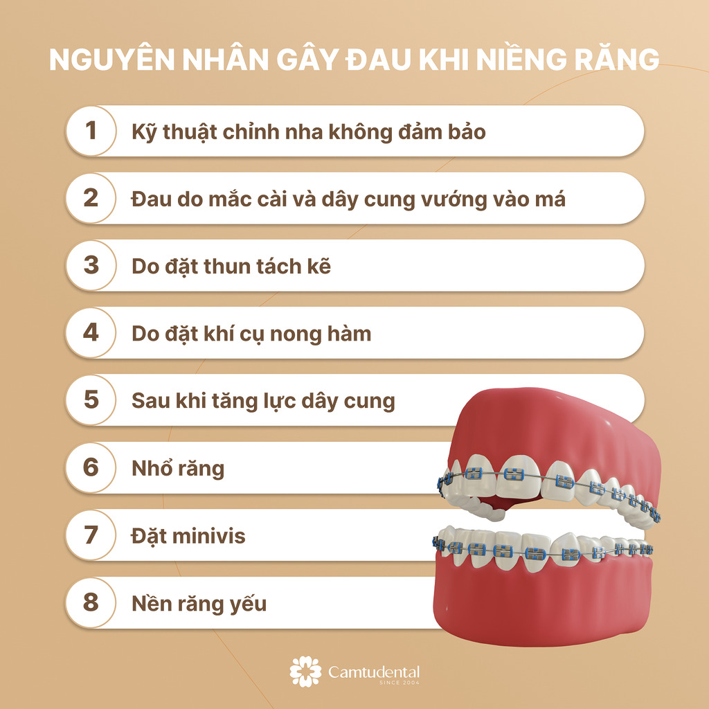 Tổng hợp một số nguyên nhân gây đau khi niềng răng là: Kỹ thuật chỉnh nha không đảm bảo;
Nền răng yếu;
Do đặt thun tách kẽ; 
Do đặt khí cụ nong hàm;
Sau khi tăng lực dây cung;
Nhổ răng;
Đặt minivis;
Đau do mắc cài và dây cung vướng vào má;