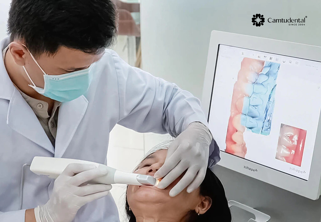 5 lợi ích của niềng răng invisalign so với các loại niềng răng khác 10 Hình ảnh lấy dấu răng bằng công nghệ 3D 3Shape