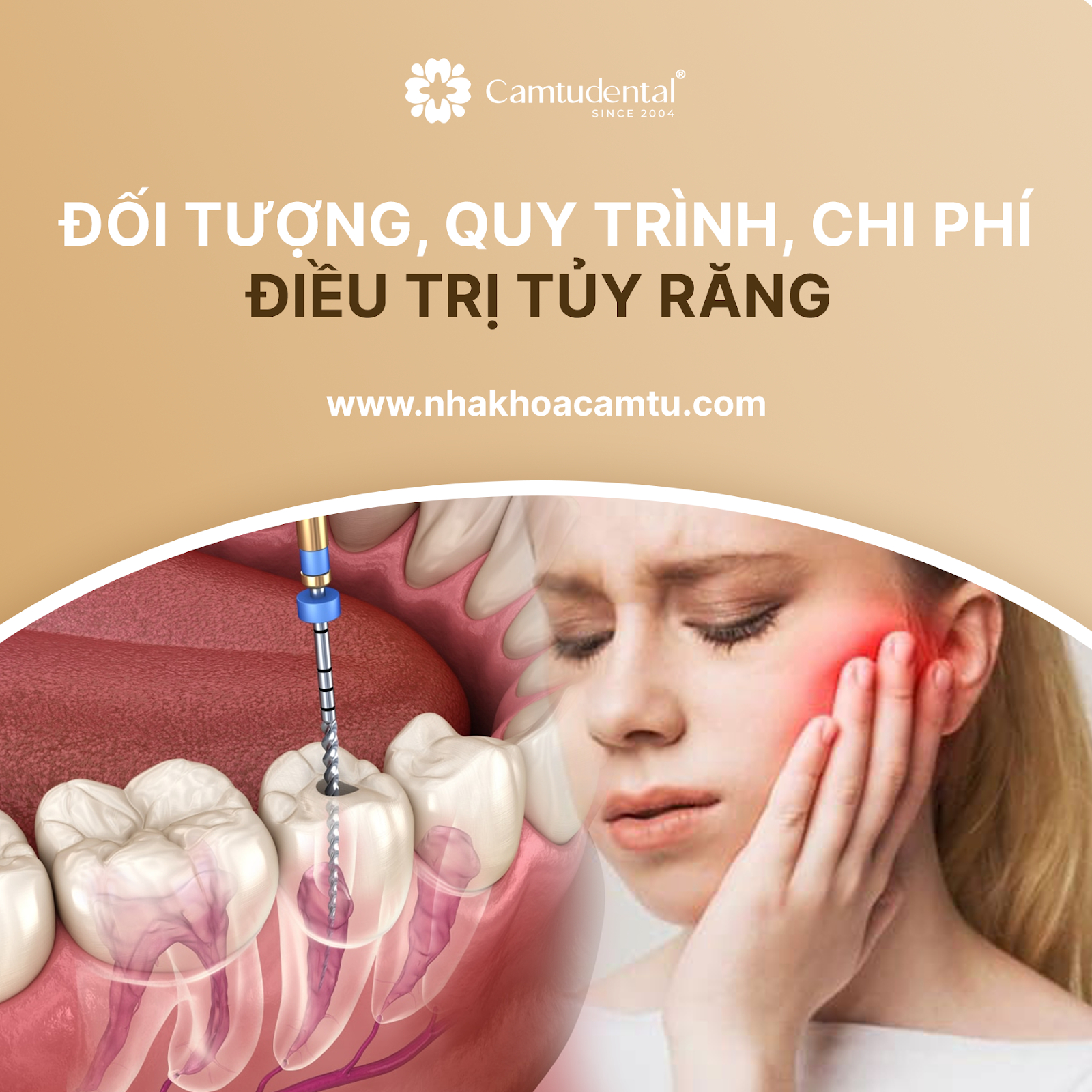 Điều Trị Tủy: Đối Tượng, Quy Trình, Chi Phí Điều Trị Tủy Răng? 1 cô gái đang đau răng và hình ảnh minh họa các bước điều trị tủy