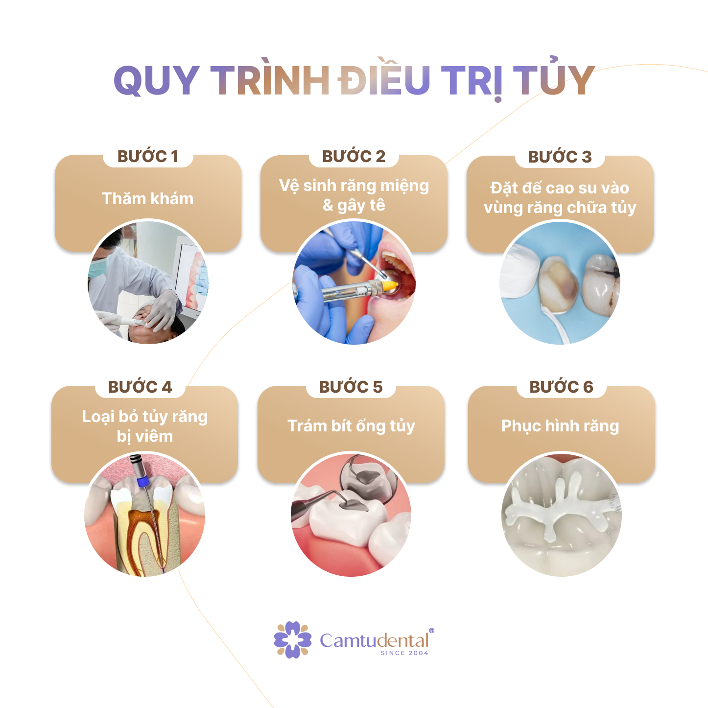 Điều Trị Tủy: Đối Tượng, Quy Trình, Chi Phí Điều Trị Tủy Răng? 5 AD 4nXe eeirNx1w23eOWl7pJNvDbR - Điều Trị Tủy: Đối Tượng, Quy Trình, Chi Phí Điều Trị Tủy Răng? - Hệ thống Nha khoa Cẩm Tú