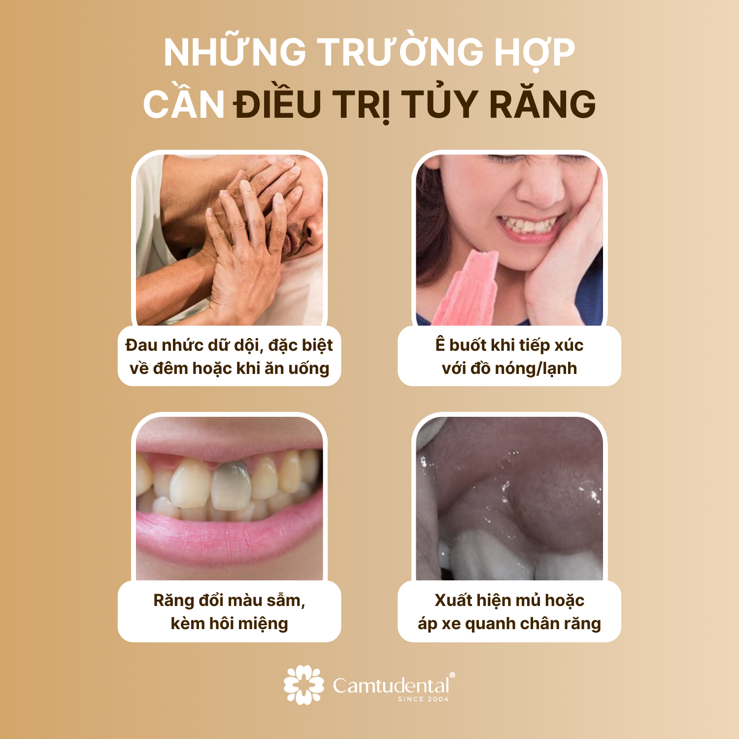 Điều Trị Tủy: Đối Tượng, Quy Trình, Chi Phí Điều Trị Tủy Răng? 4 5 Những trường hợp nên điều trị tủy răng