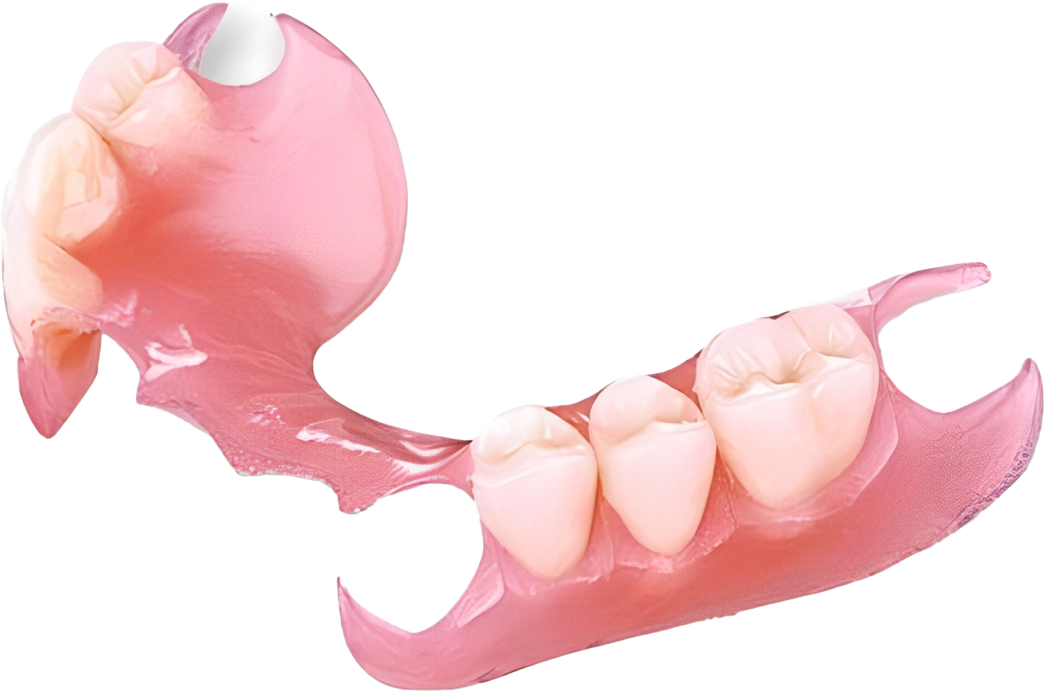 Hàm khung nhựa dẻo