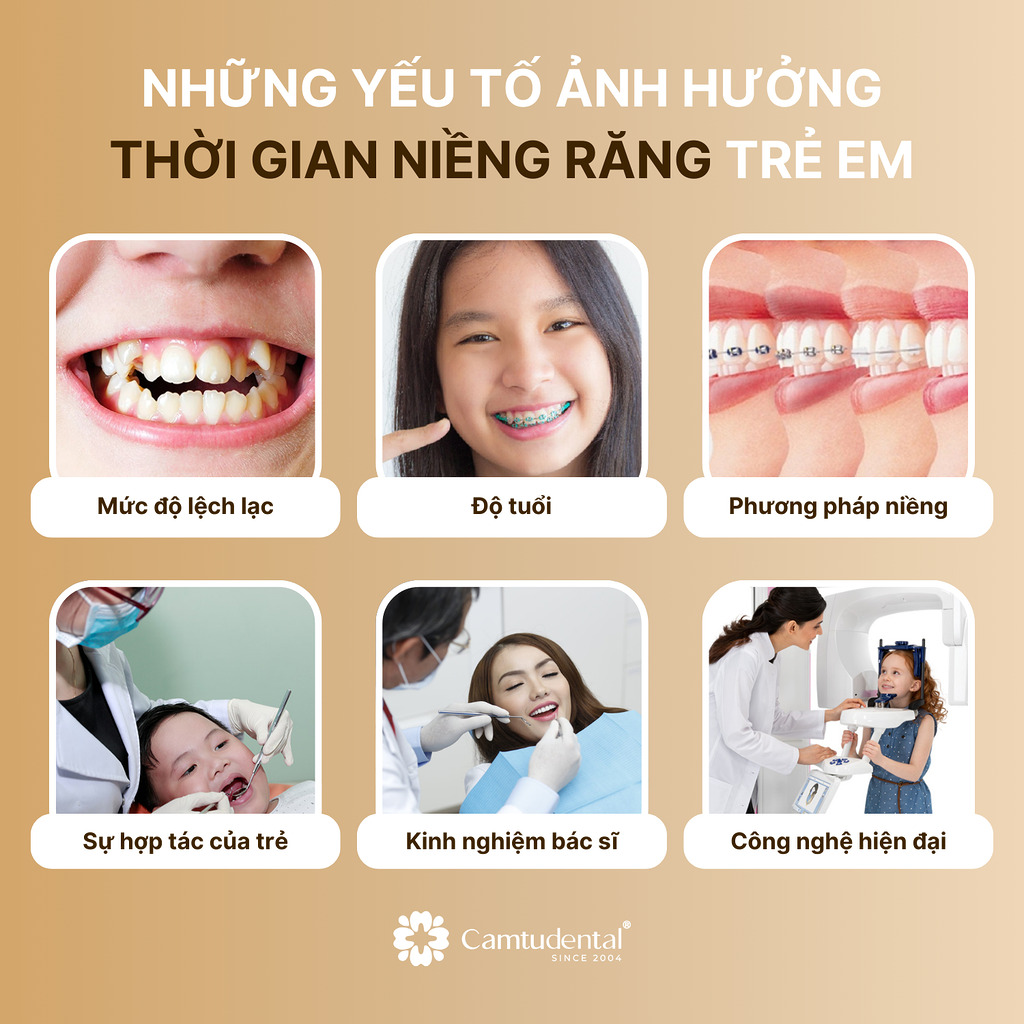 Niềng răng trẻ em: Bao lâu thì hoàn thành và chi phí ra sao? 4 6 yếu tố ảnh hưởng đến thời gian niềng răng trẻ em