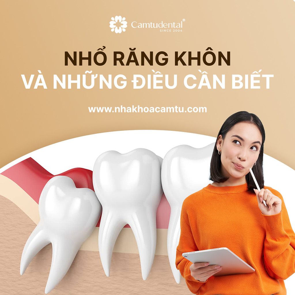 những điều cần lưu ý khi nhổ răng khôn