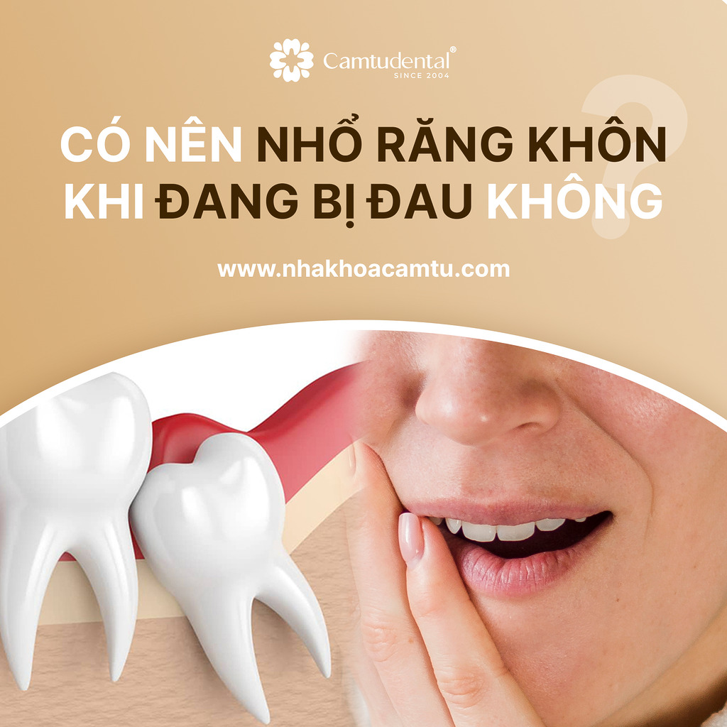 ảnh minh họa răng khôn mọc lệch và người phụ nữa đang đau răng khôn