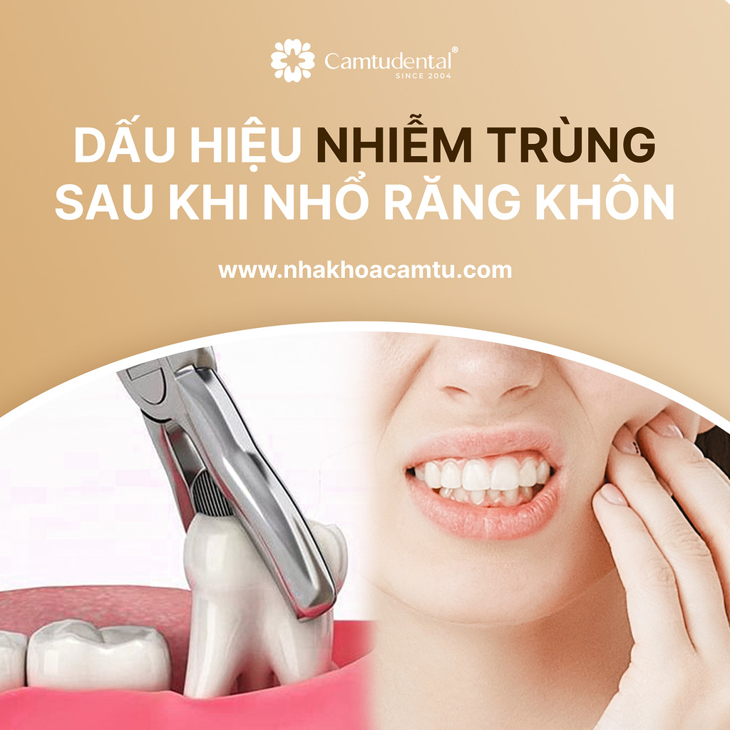 Dấu hiệu nhiễm trùng sau khi nhổ răng khôn