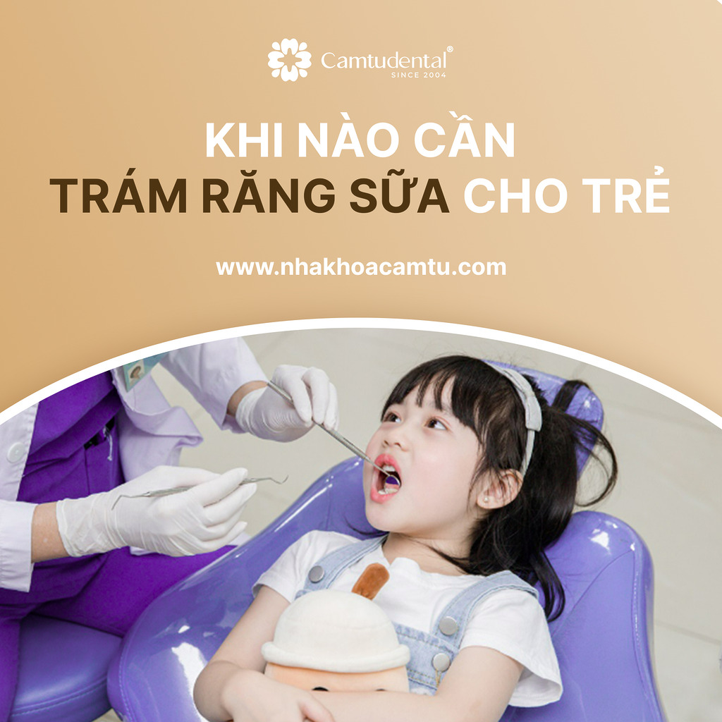 Khi nào cần trám răng sữa cho trẻ? 1 bác sĩ đang trám răng sữa cho bé gái
