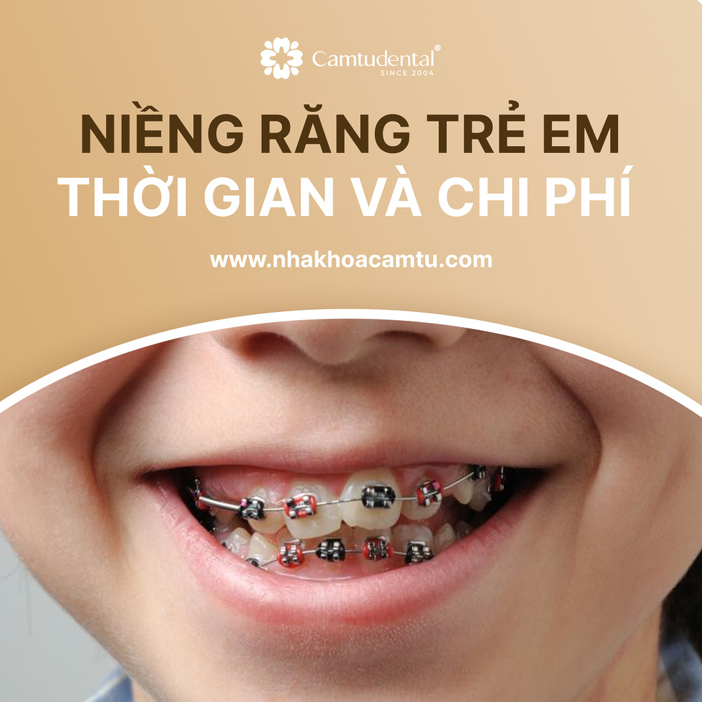 niềng răng trẻ em