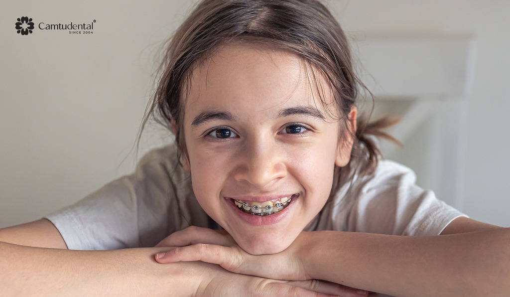 Niềng răng trẻ em: Bao lâu thì hoàn thành và chi phí ra sao? 3 bé gái đeo niềng răng khi cười