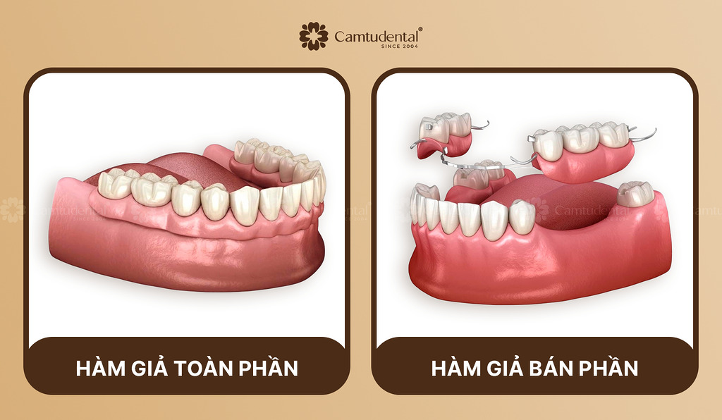 phân biệt hàm giả tháo lắp toàn phần và bán phần