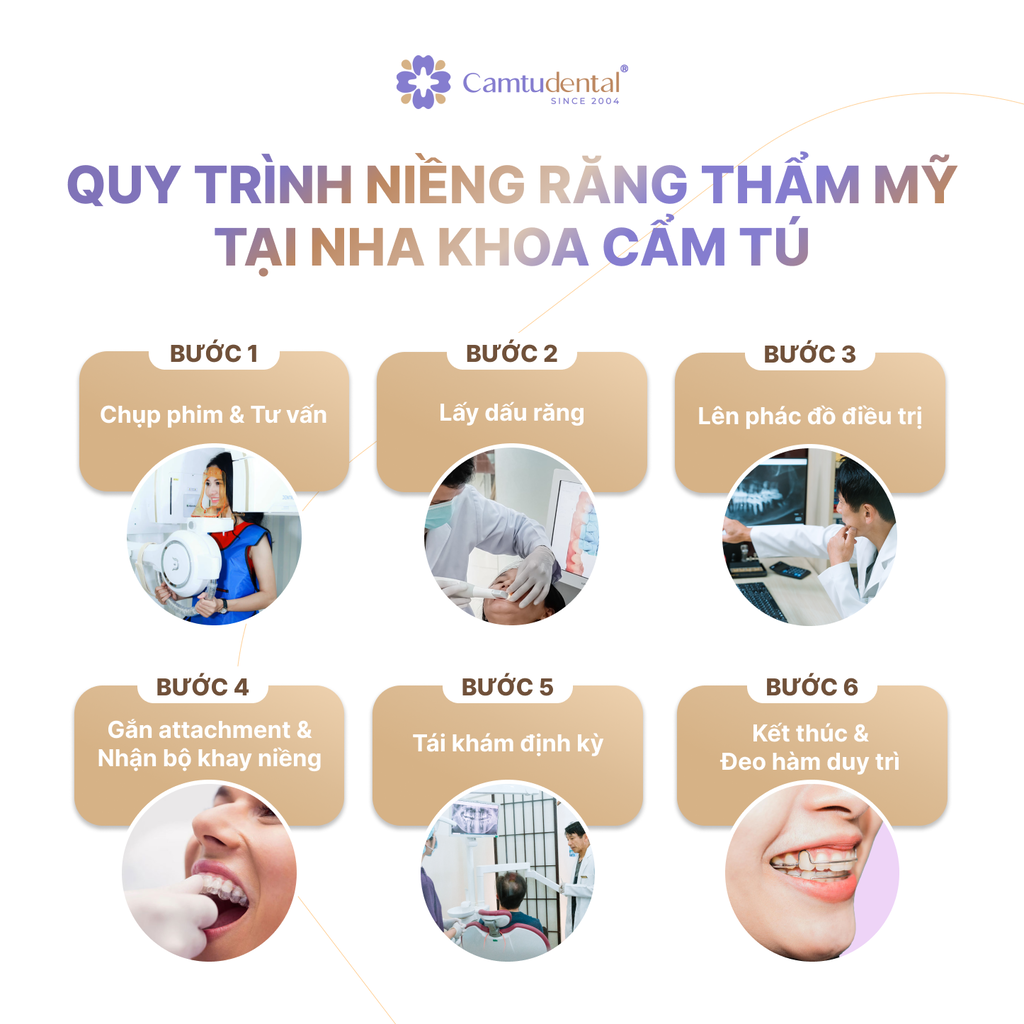 Niềng Răng Thẩm Mỹ: Tất Tần Tật Những Điều Cần Biết Về Niềng Răng 12 6 bước quy trình niềng răng thẩm mỹ tại nha khoa Cẩm Tú