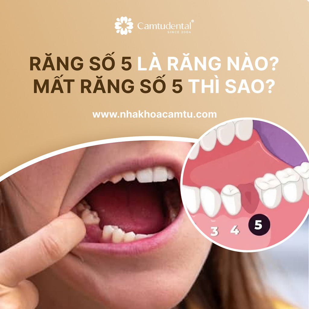 răng số 5 là răng nào