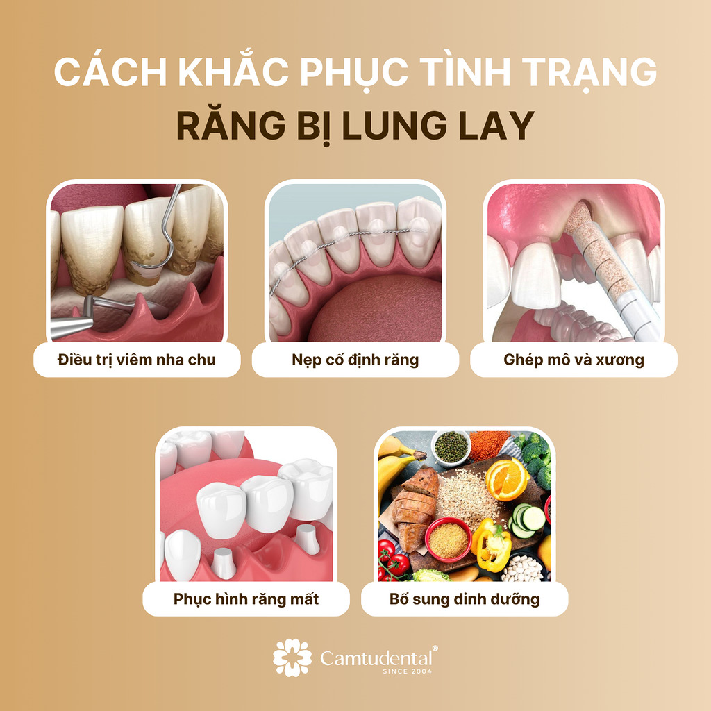 5 cách khắc phục răng đang bị lung lay