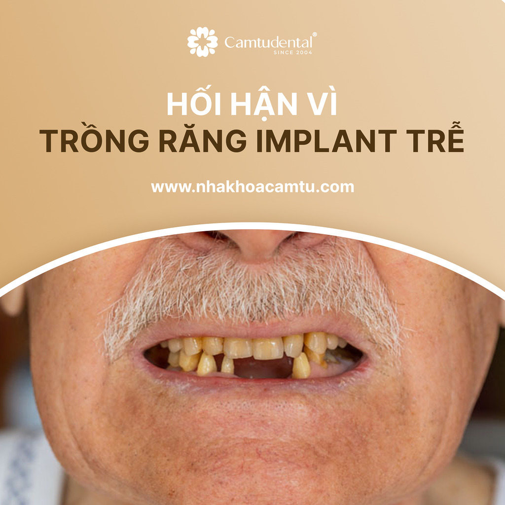 hối hận vì trồng răng implant trễ