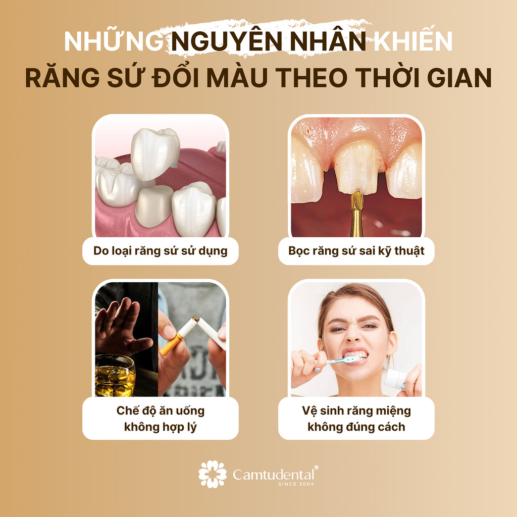 Bọc Răng Sứ Có Tẩy Trắng Được Không? 3 những nguyên nhân khiến răng sứ đổi màu theo thời gian