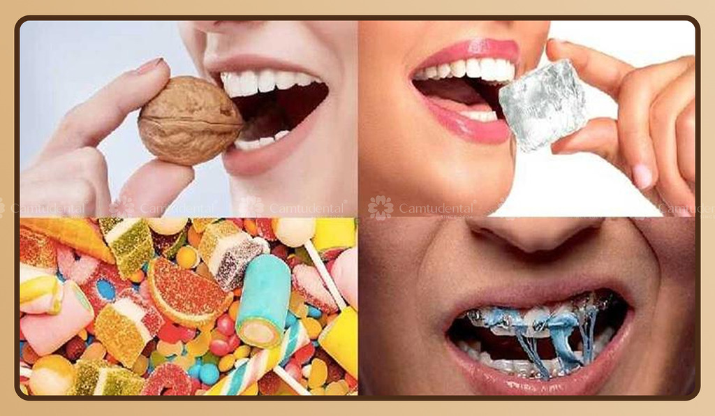 Những điều cần chuẩn bị trước khi niềng răng, bạn có biết? 12 image 1 8 - Những điều cần chuẩn bị trước khi niềng răng, bạn có biết? - Hệ thống Nha khoa Cẩm Tú