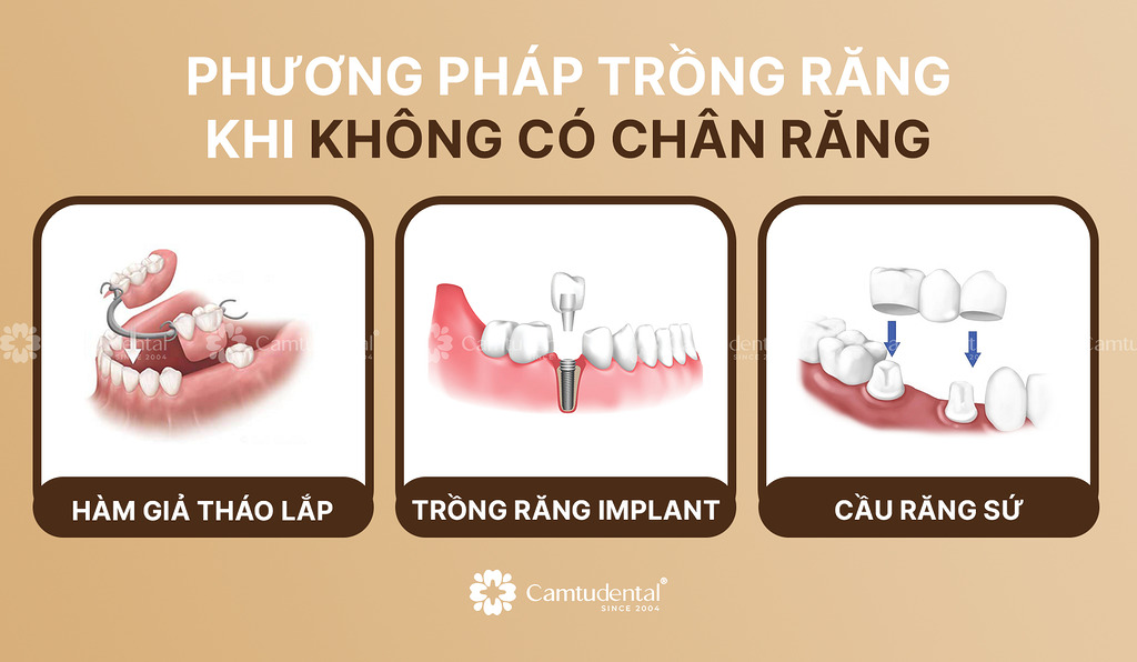 image 16 - Trồng răng không có chân răng được không? Những điều cần biết - Hệ thống Nha khoa Cẩm Tú