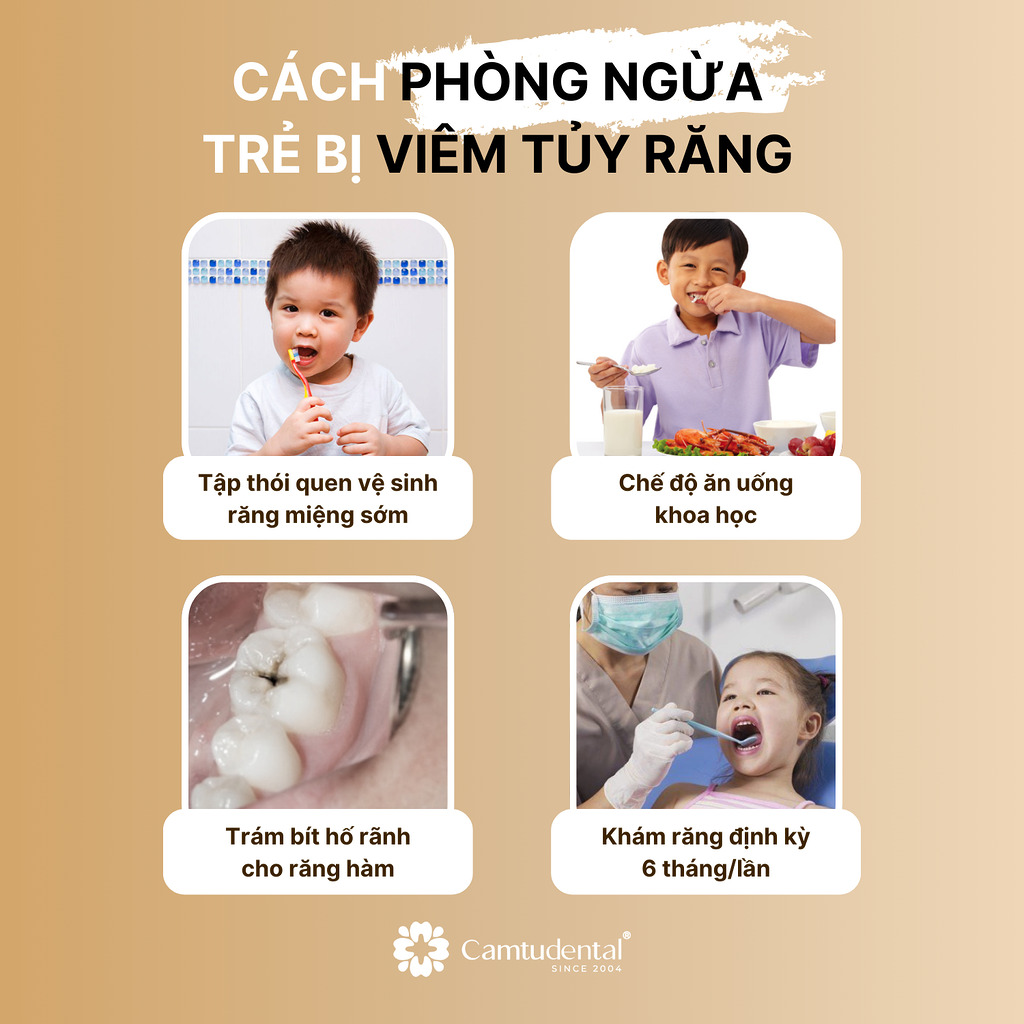 Viêm Tủy Răng Sữa: Nguyên Nhân, Dấu Hiệu và Cách Phòng Ngừa 8 4 biện pháp phòng ngừa trẻ bị viêm tủy răng sữa