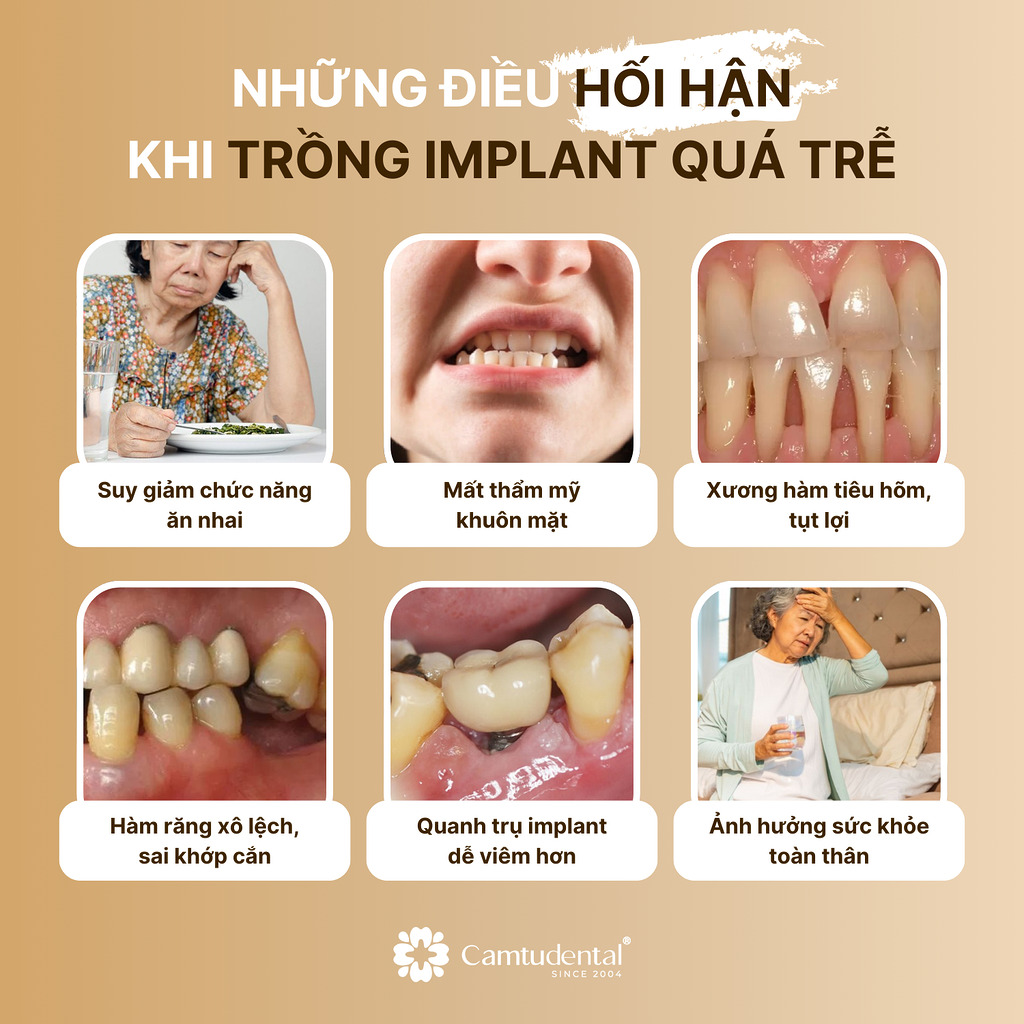 6 điều hối hận khi trồng răng implanr quá trễ