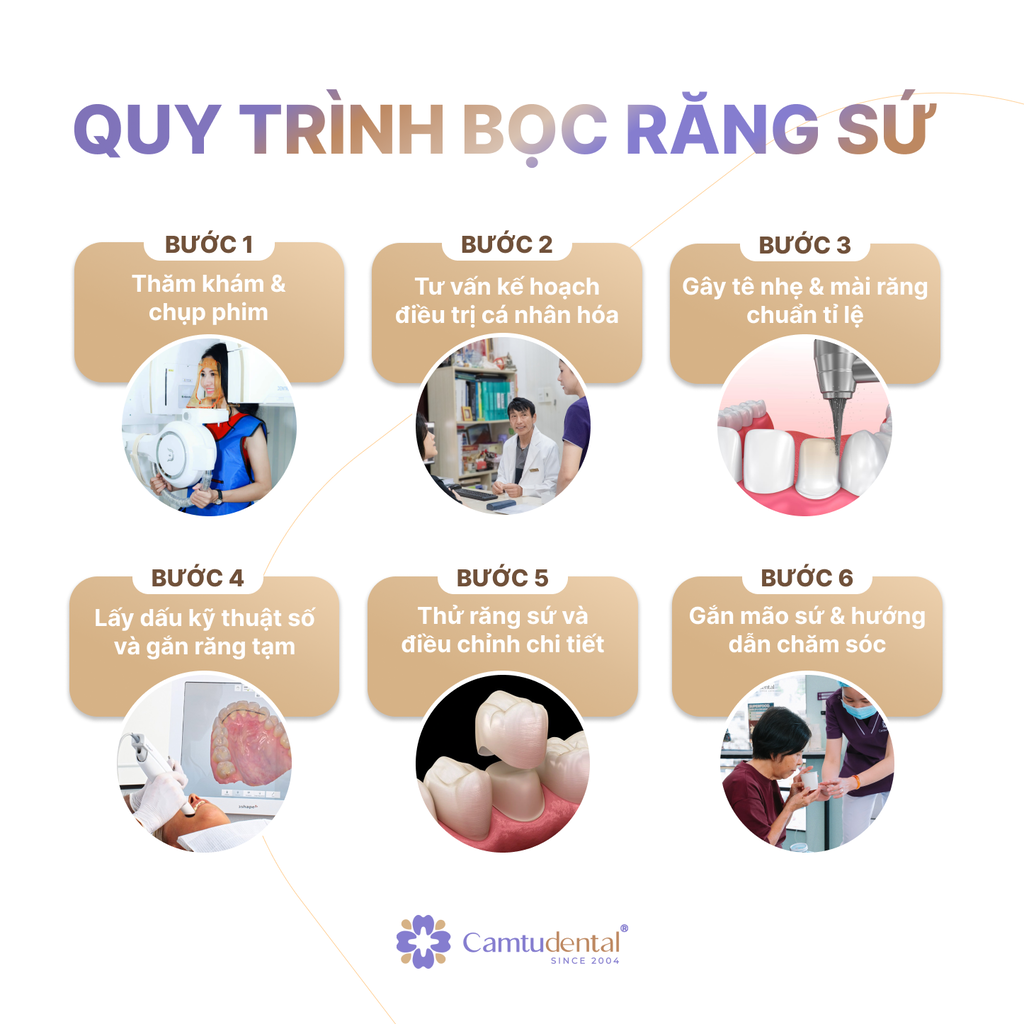 Răng Mọc Lệch Có Bọc Sứ Được Không? 4 quy trình bọc răng sứ tại Nha khoa Cẩm Tú