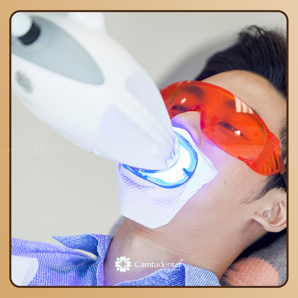 không nên tẩy trắng răng sứ