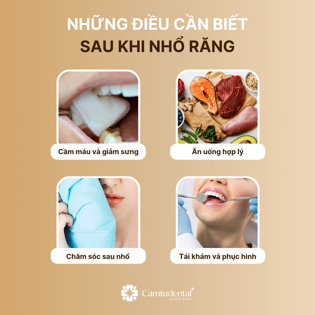 những điều cần biết sau khi nhô răng