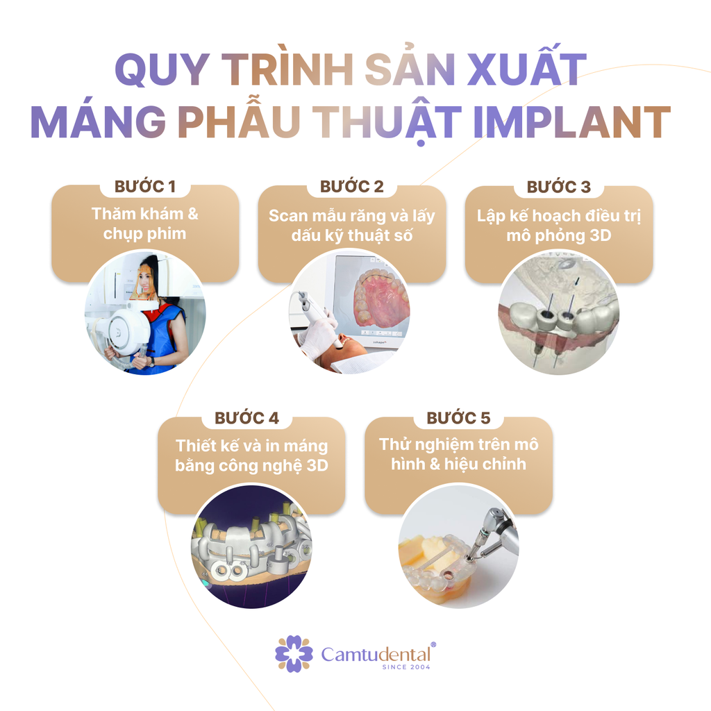 Quy Trình Sản Xuất Máng Hướng Dẫn Phẫu Thuật Implant Tại Cẩm Tú