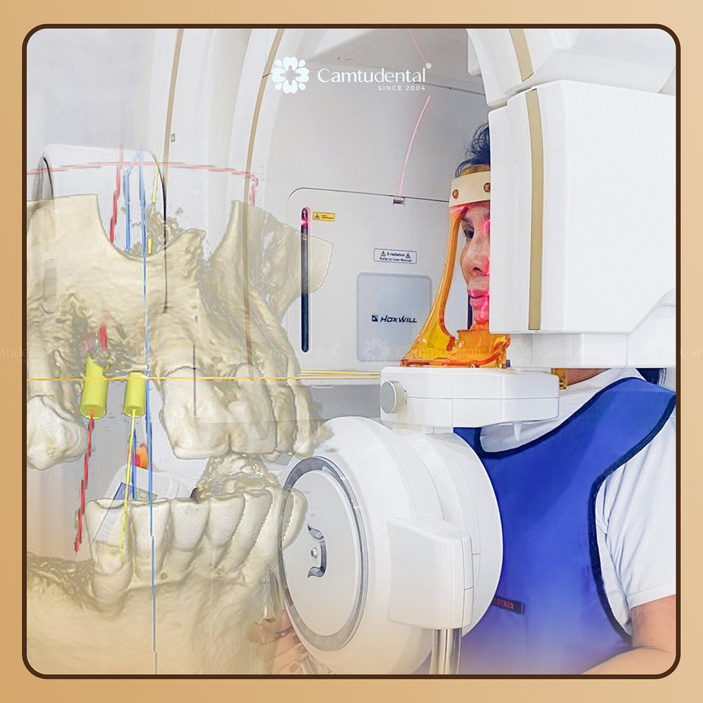 chụp phim cone beam ct