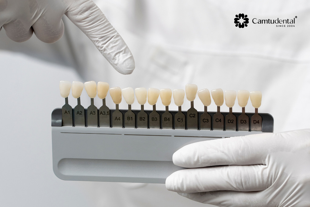 Bọc Sứ 2 Răng Cửa Giá Bao Nhiêu? Thông Tin Chi Tiết 2 boc sứ 2 răng cửa