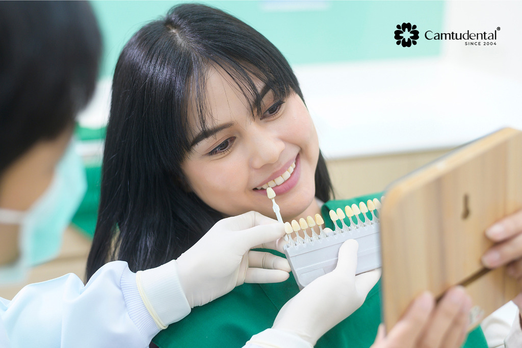 Bọc Sứ 2 Răng Cửa Giá Bao Nhiêu? Thông Tin Chi Tiết 4 bọc sứ 2 răng cửa