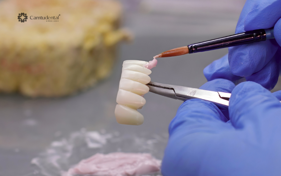 mài răng bọc sứ đau không