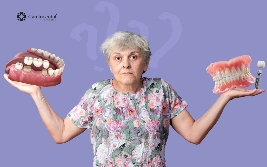 so sánh hàm răng tháo lắp giả với các lựa chọn khác