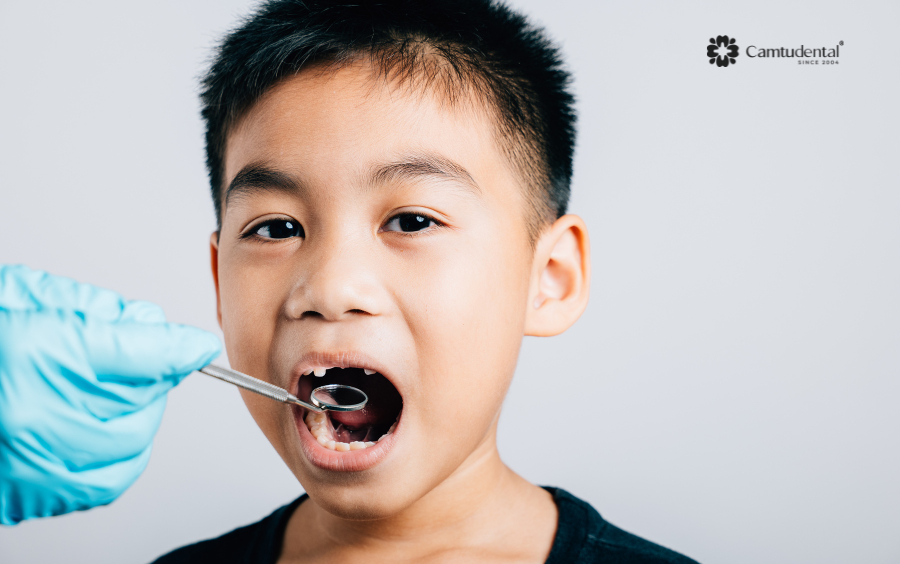 Viêm nha chu ở trẻ em phải làm sao? 4 Viem nha chu o tre em khi nao can kham ngay - Viêm nha chu ở trẻ em phải làm sao? - Hệ thống Nha khoa Cẩm Tú