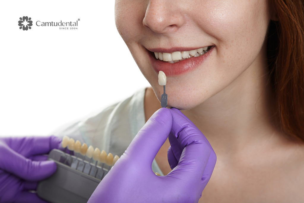 Có nên tẩy trắng răng không? 3 Có nên tẩy trắng răng