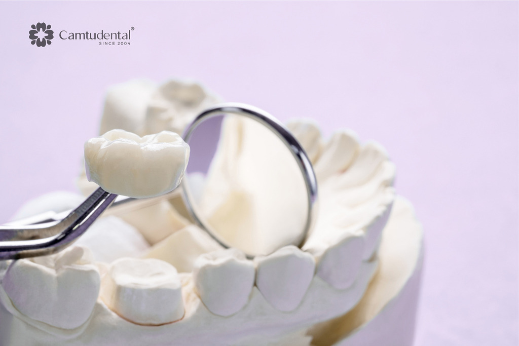 Cách tránh biến chứng sau khi bọc răng sứ