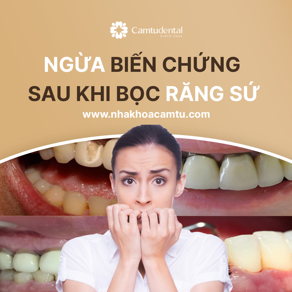các biến chứng sau khi bọc răng sứ