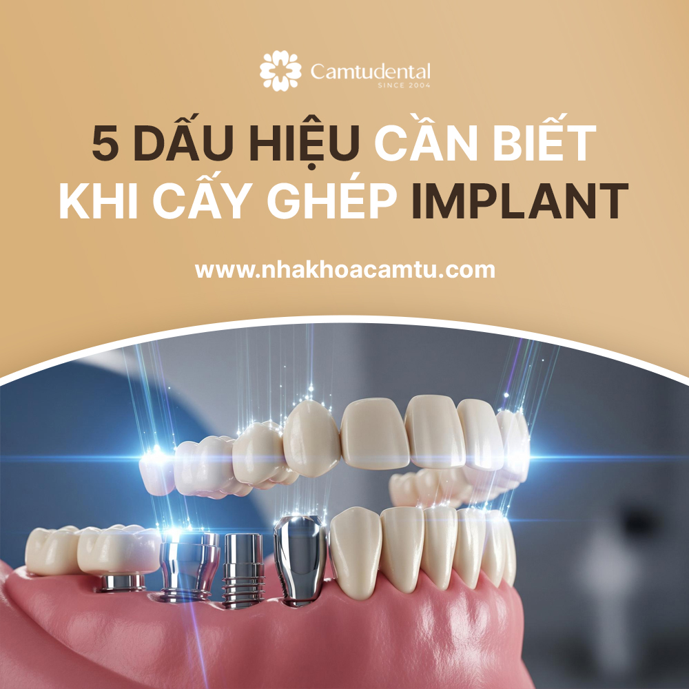 hối hận khi trồng implant