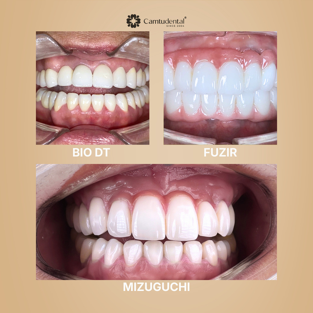 sứ Mizuguchi và các dòng sứ khác